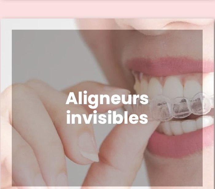 Aligneurs dentaires invisibles