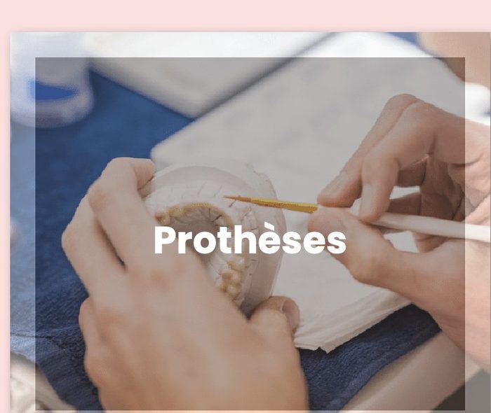 Fabrication de prothèses dentaires